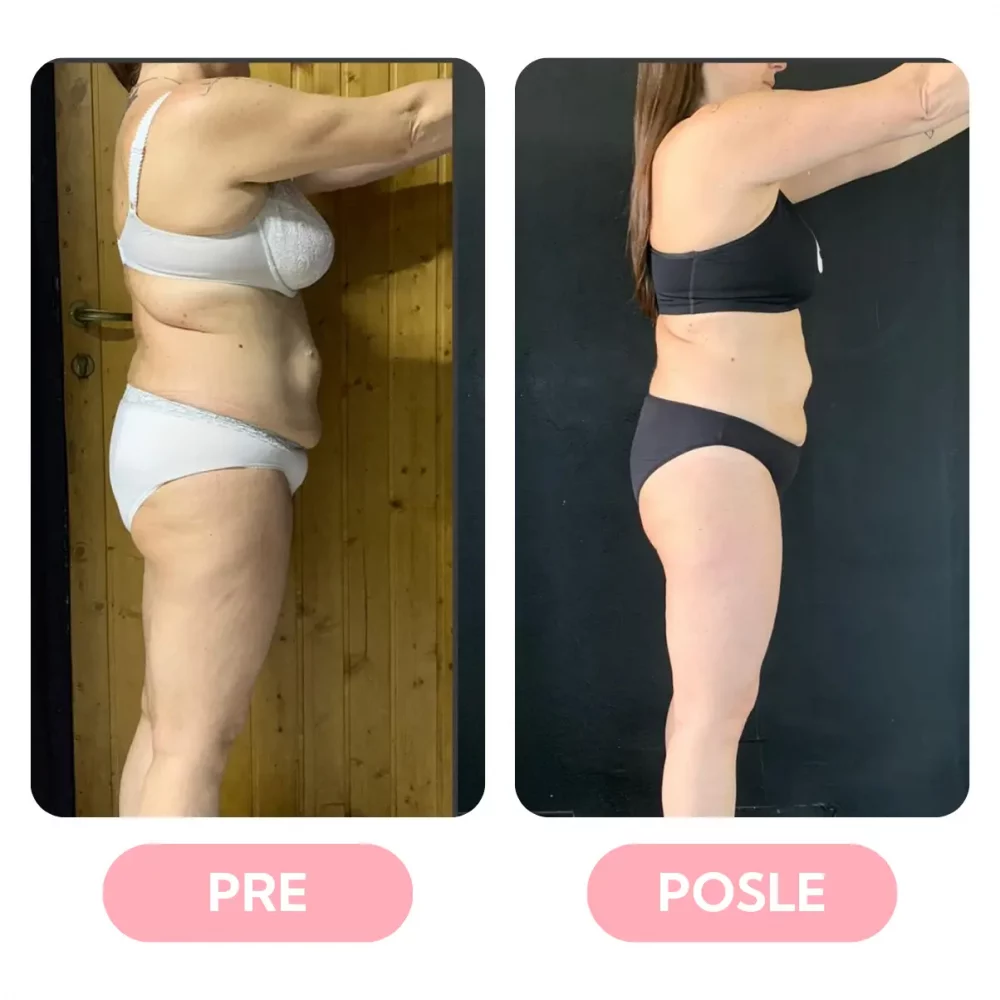 natasa-svabic-personalni-trener-online-treninzi-pre-posle-rezultati (5)
