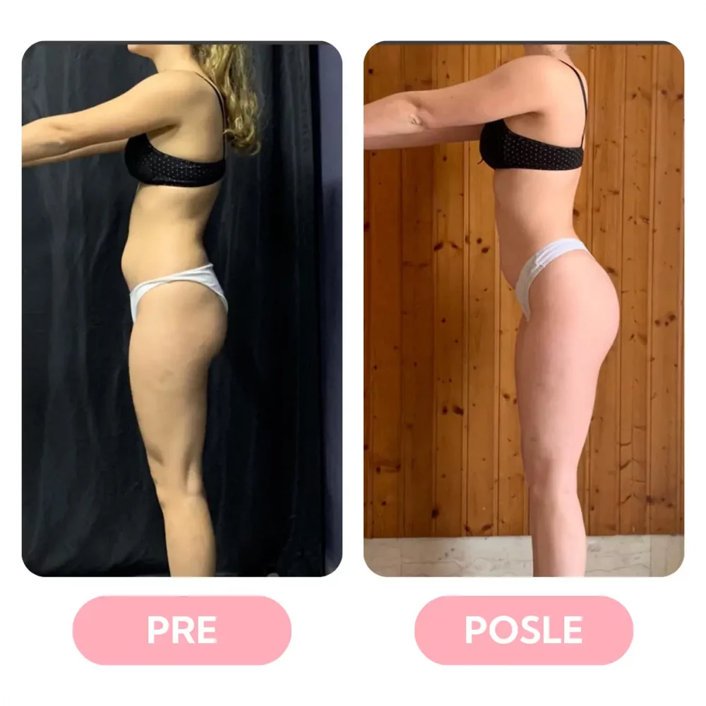 natasa-svabic-personalni-trener-online-treninzi-pre-posle-rezultati (7)
